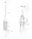 Fig. 02 - DELIVERY AND ADMINISTRATION OF COMPOSITIONS USING INTERVENTIONAL CATHETERS