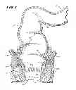 Fig. 02 - Method for treating fecal incontinence