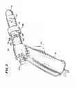 Fig. 08 - Method for treating fecal incontinence