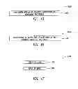 Fig. 12 - Ultrasound imaging system apparatus and method with ADC saturation monitor