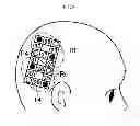 Fig. 04 - Cognitive impairment determination apparatus, cognitive impairment determination system and program