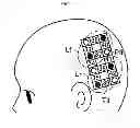 Fig. 05 - Cognitive impairment determination apparatus, cognitive impairment determination system and program