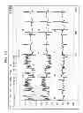 Fig. 08 - WIRELESS MULTI-SENSOR PLATFORM FOR CONTINUOUS REAL-TIME MONITORING OF CARDIOVASCULAR RESPIRATORY DYNAMICS