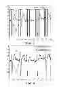 Fig. 09 - Determining onsets and offsets of cardiac depolarization and repolarization waves