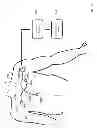 Fig. 16 - Internet-based system for evaluating ECG waveforms to determine the presence of p-mitrale and p-pulmonale