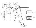 Fig. 01 - Internet-based system for evaluating ECG waveforms to estimate the degree of coronary blockage