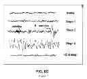 Fig. 12 - Sleep tracking and waking optimization system and method therefor
