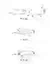 Fig. 03 - MODEL FOR TRAUMATIC BRAIN INJURY