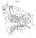 Fig. 03 - Evaluation of an implanted prosthesis