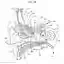 Fig. 09 - Evaluation of an implanted prosthesis