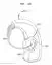 Fig. 17 - Evaluation of an implanted prosthesis