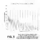 Fig. 05 - System and method for electrocardiogram analysis and optimization of cardiopulmonary resuscitation and therapy delivery