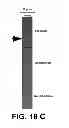 Fig. 19 - System and method for electrocardiogram analysis and optimization of cardiopulmonary resuscitation and therapy delivery