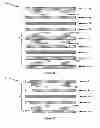 Fig. 06 - Actuator for delivery of vibratory stimulation to an area of the body and method of application