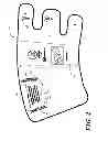 Fig. 05 - Compression device with sizing indicia