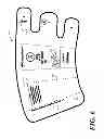 Fig. 07 - Compression device with sizing indicia