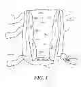 Fig. 02 - Heel protector and corresponding rehabilitation systems and methods for using the same