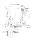 Fig. 03 - Heel protector and corresponding rehabilitation systems and methods for using the same