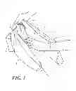 Fig. 04 - Heel protector and corresponding rehabilitation systems and methods for using the same