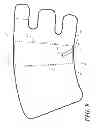 Fig. 10 - Heel protector and corresponding rehabilitation systems and methods for using the same