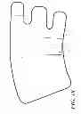 Fig. 11 - Heel protector and corresponding rehabilitation systems and methods for using the same