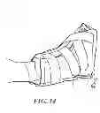 Fig. 15 - Heel protector and corresponding rehabilitation systems and methods for using the same