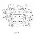 Fig. 05 - INFLATABLE WRAP WITH AUTOMATIC TIGHTNESS DETECTION