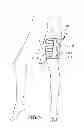 Fig. 06 - INFLATABLE WRAP WITH AUTOMATIC TIGHTNESS DETECTION