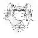 Fig. 03 - Cervical collar with cable adjustment system