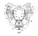 Fig. 06 - Cervical collar with cable adjustment system