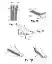 Fig. 06 - Disposable two-part orthotic foot support strap system and method