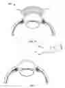Fig. 10 - Ocular implant with shape change capabilities