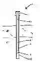 Fig. 01 - LAPAROSCOPIC DELIVERY  DEVICE