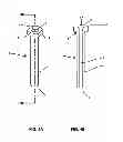 Fig. 05 - LAPAROSCOPIC DELIVERY  DEVICE