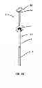 Fig. 07 - LAPAROSCOPIC DELIVERY  DEVICE