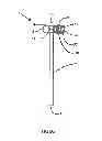 Fig. 09 - LAPAROSCOPIC DELIVERY  DEVICE