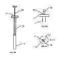Fig. 13 - LAPAROSCOPIC DELIVERY  DEVICE