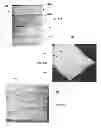 Fig. 23 - Compressive oxygen diffusive wound dressings