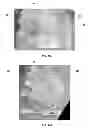 Fig. 24 - Compressive oxygen diffusive wound dressings