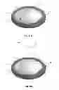 Fig. 29 - Compressive oxygen diffusive wound dressings