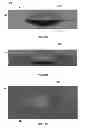 Fig. 32 - Compressive oxygen diffusive wound dressings