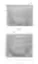 Fig. 04 - Oxygen diffusive wound dressings and methods of manufacturing and use