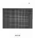 Fig. 06 - Oxygen diffusive wound dressings and methods of manufacturing and use