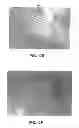 Fig. 18 - Oxygen diffusive wound dressings and methods of manufacturing and use