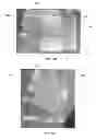 Fig. 24 - Oxygen diffusive wound dressings and methods of manufacturing and use