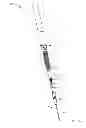 Fig. 10 - Systems and methods for delivering a fluid to a patient with reduced contamination
