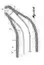 Fig. 12 - INTRAOCULAR IRRIGATOR-ASPIRATOR TIP COMPONENT