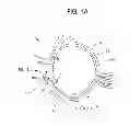 Fig. 02 - Methods and devices for drug delivery to ocular tissue using microneedle
