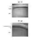 Fig. 10 - Methods and devices for drug delivery to ocular tissue using microneedle
