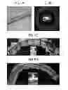 Fig. 11 - Methods and devices for drug delivery to ocular tissue using microneedle